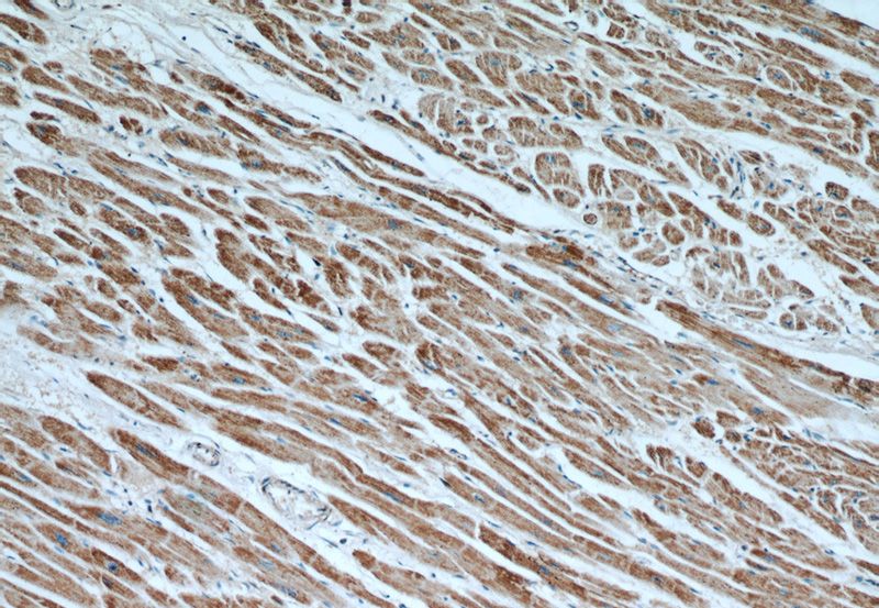 Immunohistochemical of paraffin-embedded human heart using Catalog No:107071(ATP5A1 antibody) at dilution of 1:50 (under 10x lens)