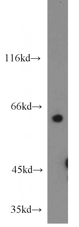 HeLa cells were subjected to SDS PAGE followed by western blot with Catalog No:109170(CDKN2AIP antibody) at dilution of 1:1000