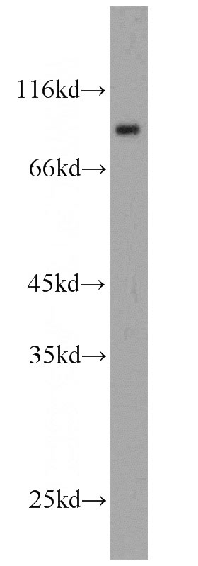HeLa cells were subjected to SDS PAGE followed by western blot with Catalog No:109592(UNR; CSDE1 antibody) at dilution of 1:1000