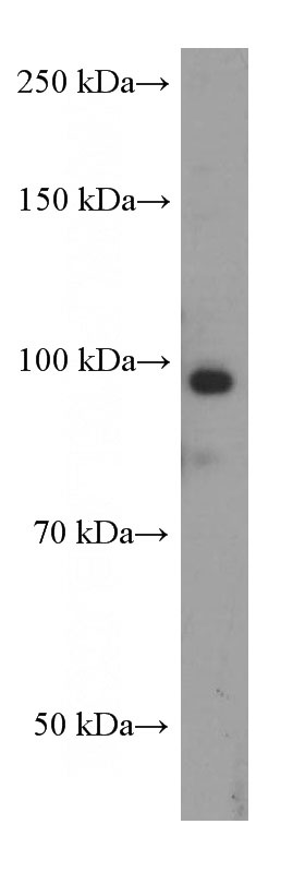 HeLa cells were subjected to SDS PAGE followed by western blot with (MALT1 Antibody) at dilution of 1:1000