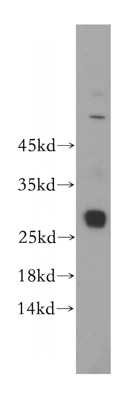 HepG2 cells were subjected to SDS PAGE followed by western blot with Catalog No:111194(GSTT2B antibody) at dilution of 1:500