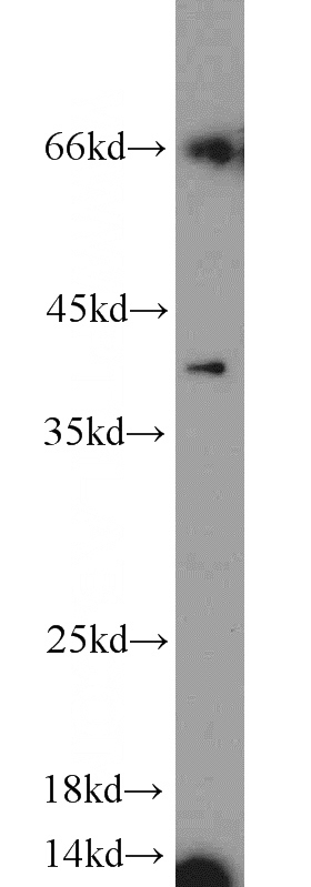 MCF7 cells were subjected to SDS PAGE followed by western blot with Catalog No:111902(KLK11 antibody) at dilution of 1:1000