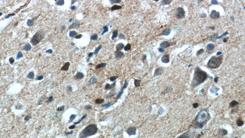 Immunohistochemistry of paraffin-embedded human brain tissue slide using Catalog No:109305(CHURC1 Antibody) at dilution of 1:50 (under 40x lens)