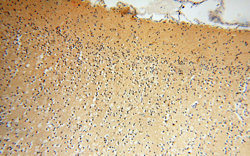 Immunohistochemical of paraffin-embedded human brain using Catalog No:110925(GDI1 antibody) at dilution of 1:50 (under 10x lens)