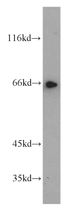 Jurkat cells were subjected to SDS PAGE followed by western blot with Catalog No:116009(TFEB antibody) at dilution of 1:1000