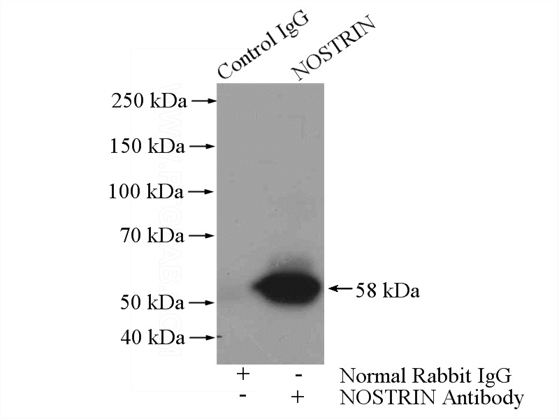 IP Result of anti-NOSTRIN (IP:Catalog No:113306, 4ug; Detection:Catalog No:113306 1:500) with human placenta tissue lysate 1600ug.