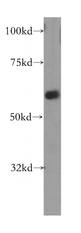mouse kidney tissue were subjected to SDS PAGE followed by western blot with Catalog No:112483(MARVELD2 antibody) at dilution of 1:800