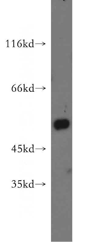 mouse lung tissue were subjected to SDS PAGE followed by western blot with Catalog No:109695(CYP2F1 antibody) at dilution of 1:500