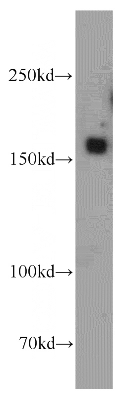 mouse brain tissue were subjected to SDS PAGE followed by western blot with Catalog No:110628(FGD5 antibody) at dilution of 1:500