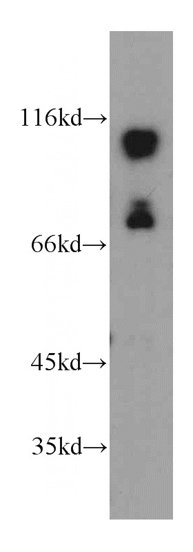 HEK-293 cells were subjected to SDS PAGE followed by western blot with Catalog No:115388(SMEK2 antibody) at dilution of 1:500
