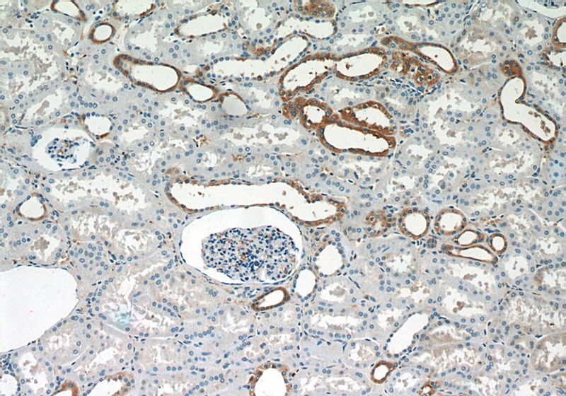 Immunohistochemistry of paraffin-embedded human kidney slide using Catalog No:115170(SLC5A4 Antibody) at dilution of 1:50