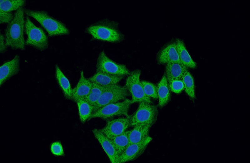 Immunofluorescent analysis of HeLa cells using Catalog No:115591(SRP19 Antibody) at dilution of 1:50 and Alexa Fluor 488-congugated AffiniPure Goat Anti-Rabbit IgG(H+L)