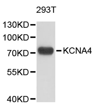 Western blot - KCNA4 Polyclonal Antibody 
