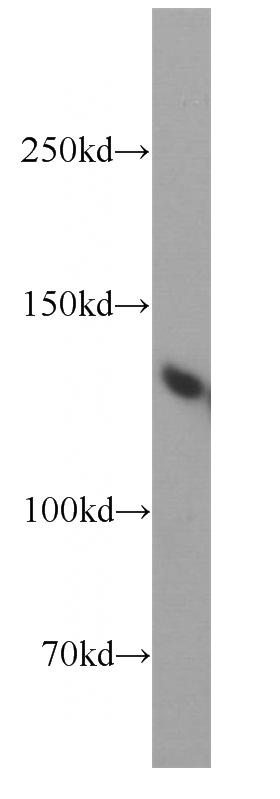 HeLa cells were subjected to SDS PAGE followed by western blot with Catalog No:117230(BRD8 antibody) at dilution of 1:500