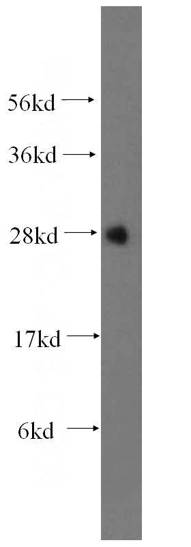 mouse liver tissue were subjected to SDS PAGE followed by western blot with Catalog No:112522(METTL7B antibody) at dilution of 1:500
