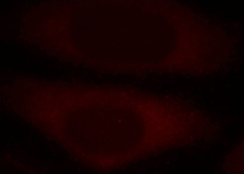 Immunofluorescent analysis of HepG2 cells, using RB1CC1 antibody Catalog No:114490 at 1:25 dilution and Rhodamine-labeled goat anti-rabbit IgG (red).