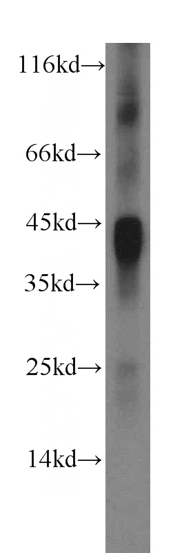 Recombinant protein were subjected to SDS PAGE followed by western blot with Catalog No:107656(IL12B antibody) at dilution of 1:5000