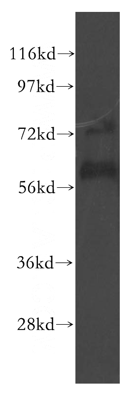 human brain tissue were subjected to SDS PAGE followed by western blot with Catalog No:112415(LYVE1 antibody) at dilution of 1:500