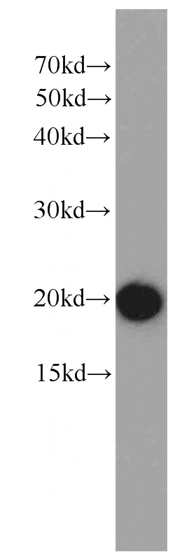 mouse brain tissue were subjected to SDS PAGE followed by western blot with Catalog No:108169(ARPC5L antibody) at dilution of 1:1000