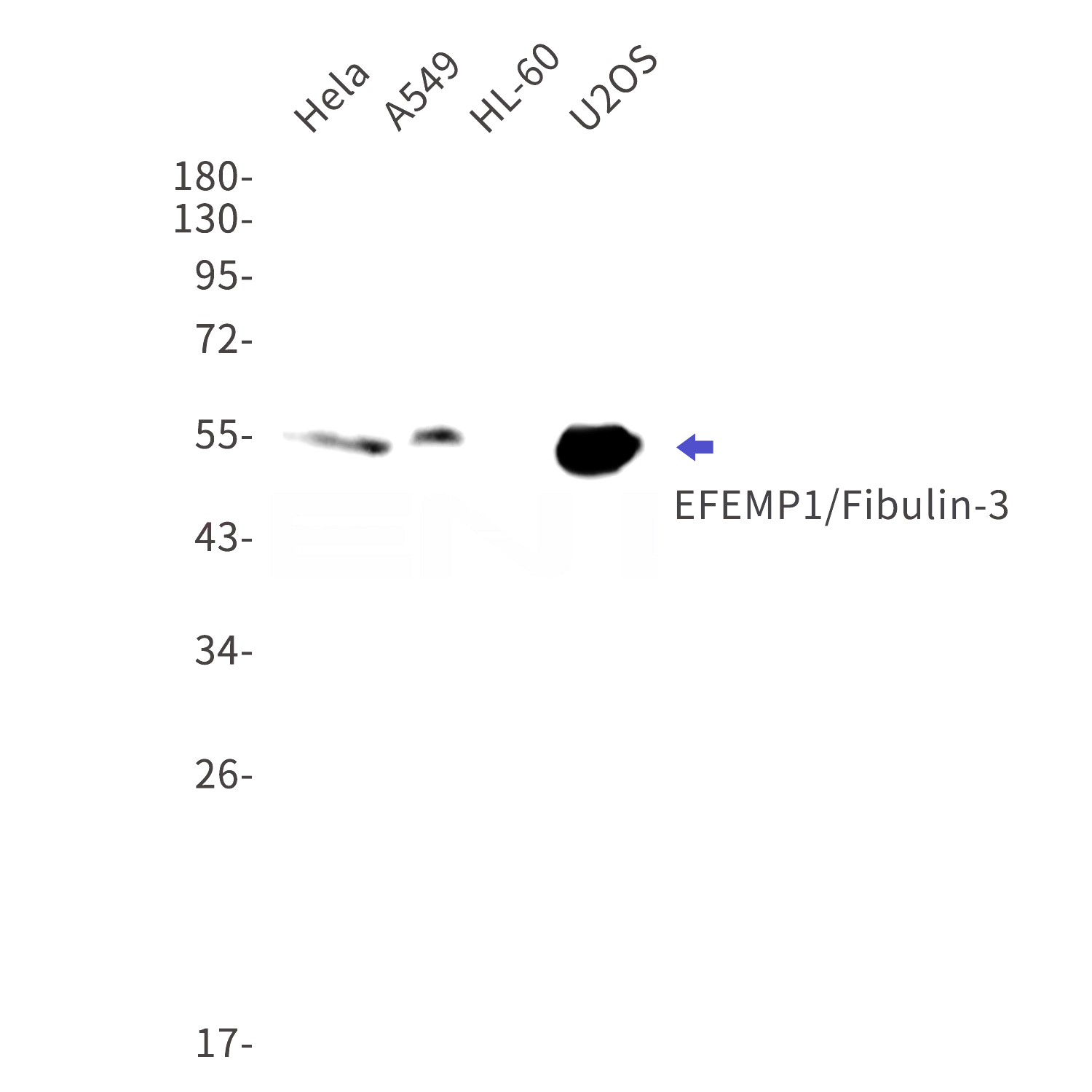Western blot detection of EFEMP1/Fibulin-3 in Hela,A549,HL-60,U2OS cell lysates using EFEMP1/Fibulin-3 Rabbit mAb(1:1000 diluted).Predicted band size:55kDa.Observed band size:55kDa.
