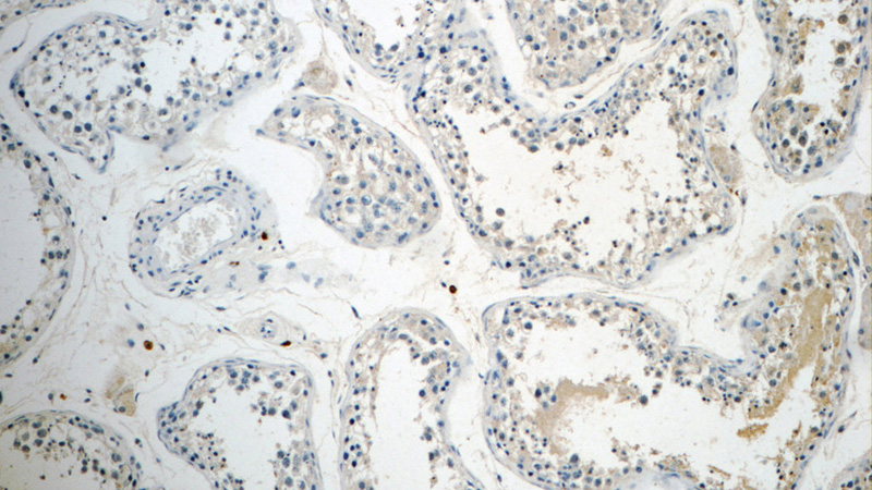 Immunohistochemistry of paraffin-embedded human testis tissue slide using Catalog No:107859(ALKBH7 Antibody) at dilution of 1:50 (under 10x lens)