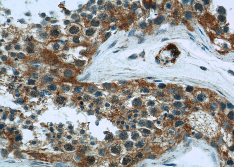 Immunohistochemical of paraffin-embedded human testis using Catalog No:111306(HK1 antibody) at dilution of 1:100 (under 40x lens)