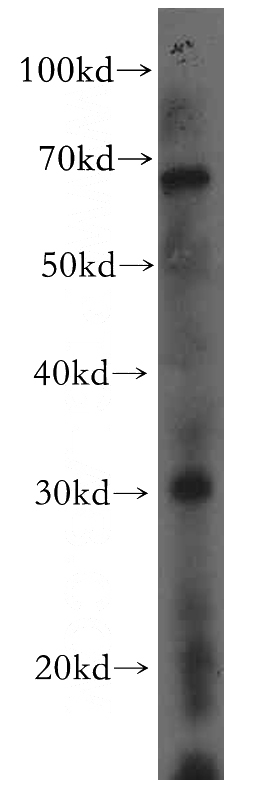 HeLa cells were subjected to SDS PAGE followed by western blot with Catalog No:112445(MARCH5 antibody) at dilution of 1:500