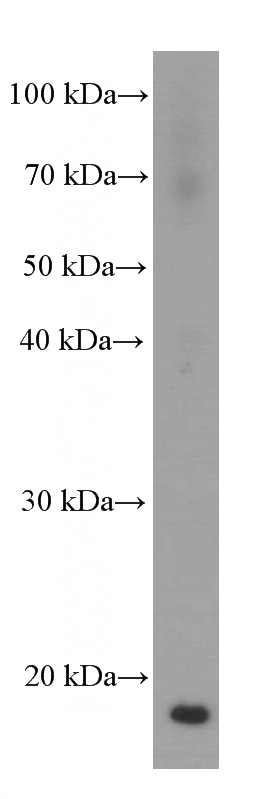 fetal human brain tissue were subjected to SDS PAGE followed by western blot with Catalog No:107170(COTL1 Antibody) at dilution of 1:2000