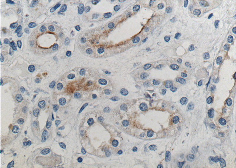 Immunohistochemistry of paraffin-embedded human kidney tissue slide using Catalog No:113195(SLC12A1 Antibody) at dilution of 1:200 (under 40x lens).