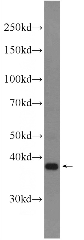L02 cells were subjected to SDS PAGE followed by western blot with Catalog No:110074(DPPA4 Antibody) at dilution of 1:300