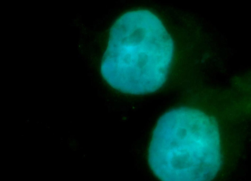 Immunofluorescent analysis of SH-SY5Y cells, using SMARCD1 antibody Catalog No:115433 at 1:50 dilution and FITC-labeled donkey anti-rabbit IgG(green). Blue pseudocolor = DAPI (fluorescent DNA dye).