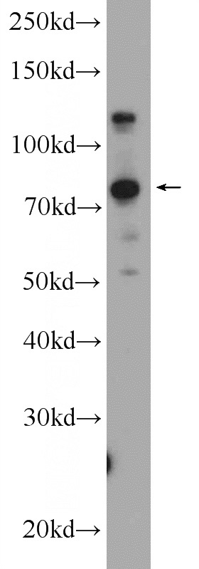 Raji cells were subjected to SDS PAGE followed by western blot with Catalog No:111994(KIAA1530 Antibody) at dilution of 1:300