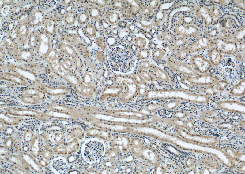 Immunohistochemical of paraffin-embedded human kidney using Catalog No:112048(KIF5B antibody) at dilution of 1:100 (under 10x lens)