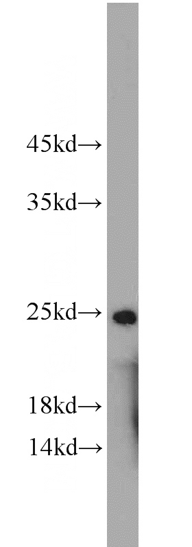 mouse heart tissue were subjected to SDS PAGE followed by western blot with Catalog No:107985(ALKBH3 antibody) at dilution of 1:1000