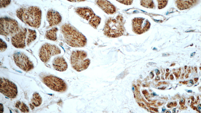 Immunohistochemistry of paraffin-embedded human heart tissue slide using Catalog No:114430(RAB31-specific Antibody) at dilution of 1:50 (under 40x lens)