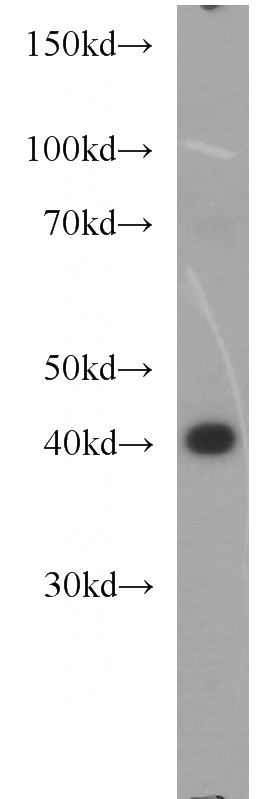 HeLa cells were subjected to SDS PAGE followed by western blot with Catalog No:111096(GMDS antibody) at dilution of 1:1000