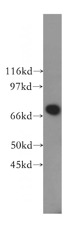 COLO 320 cells were subjected to SDS PAGE followed by western blot with Catalog No:117094(B4GALNT1 antibody) at dilution of 1:400