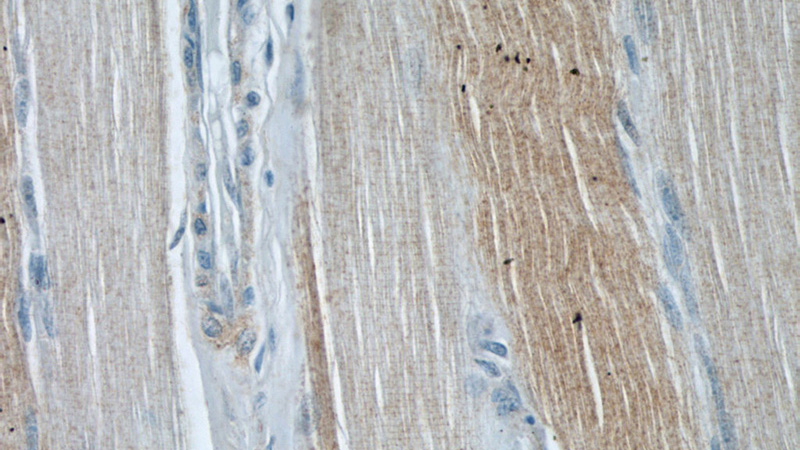 Immunohistochemical of paraffin-embedded human skeletal muscle using Catalog No:107815(ABHD5 antibody) at dilution of 1:50 (under 40x lens)