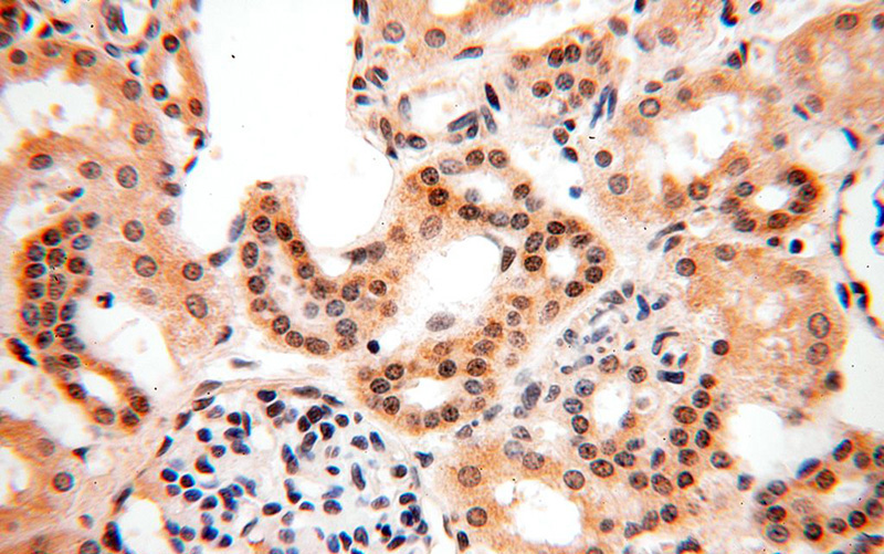 Immunohistochemical of paraffin-embedded human kidney using Catalog No:113780(PGBD3 antibody) at dilution of 1:100 (under 40x lens)