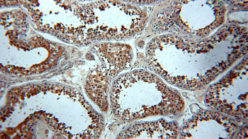 Immunohistochemical of paraffin-embedded human testis using Catalog No:116862(WDR32 antibody) at dilution of 1:100 (under 10x lens)