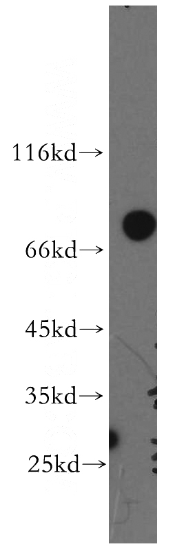 Jurkat cells were subjected to SDS PAGE followed by western blot with Catalog No:115269(SHCBP1 antibody) at dilution of 1:300
