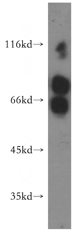 human heart tissue were subjected to SDS PAGE followed by western blot with Catalog No:112788(MTMR6 antibody) at dilution of 1:500