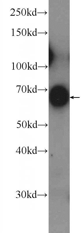 mouse heart tissue were subjected to SDS PAGE followed by western blot with Catalog No:111919(KBTBD10 Antibody) at dilution of 1:1500