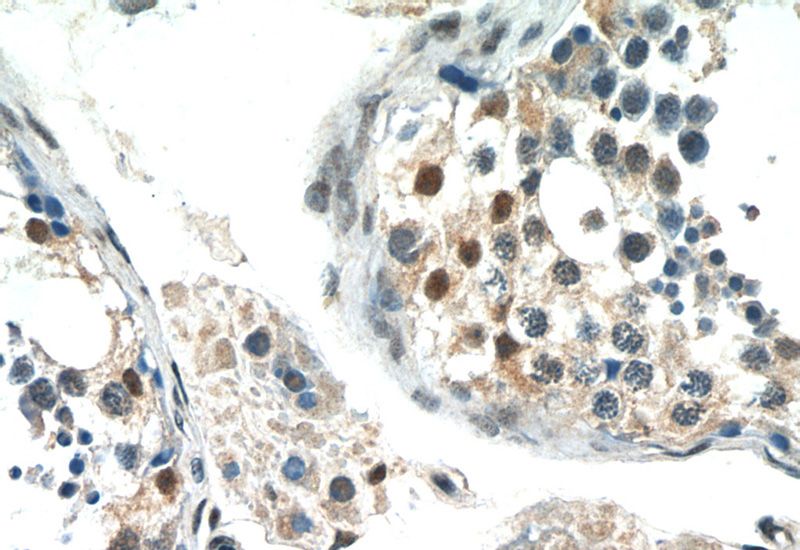 Immunohistochemistry of paraffin-embedded human testis tissue slide using Catalog No:110576(FAM164C Antibody) at dilution of 1:50 (under 40x lens)