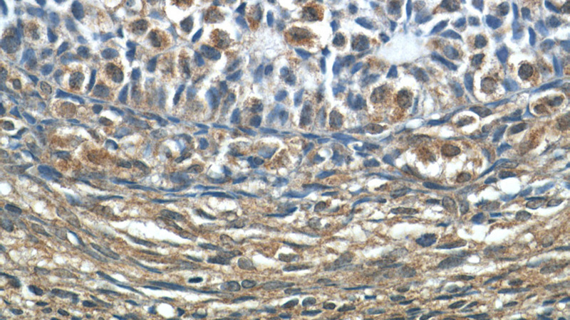 Immunohistochemistry of paraffin-embedded human ovary tissue slide using Catalog No:115177(SH2B1 Antibody) at dilution of 1:50 (under 40x lens)