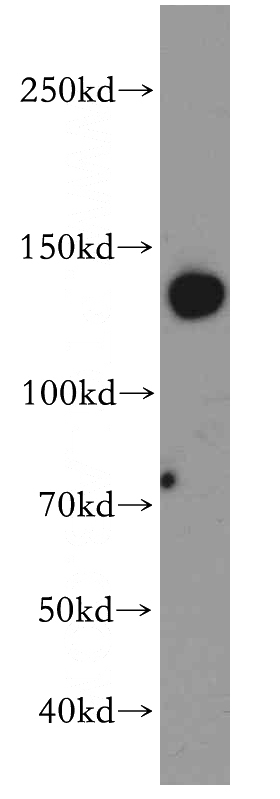mouse brain tissue were subjected to SDS PAGE followed by western blot with Catalog No:115841(SUPT16H antibody) at dilution of 1:300