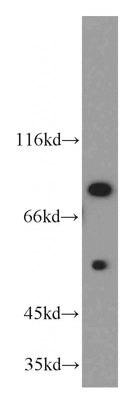 K-562 cells were subjected to SDS PAGE followed by western blot with Catalog No:109670(CCNT1 antibody) at dilution of 1:300