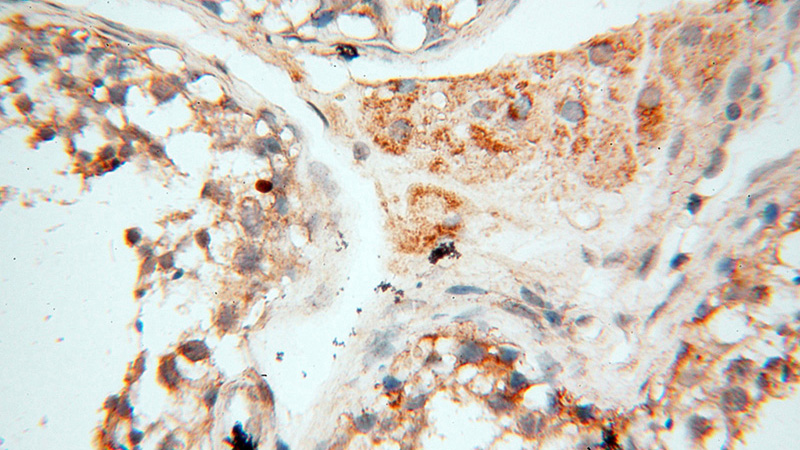 Immunohistochemical of paraffin-embedded human testis using Catalog No:112212(LGR6 antibody) at dilution of 1:50 (under 40x lens)
