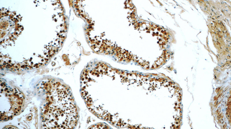 Immunohistochemistry of paraffin-embedded human testis tissue slide using Catalog No:108068(ANKRD13C Antibody) at dilution of 1:50 (under 10x lens)