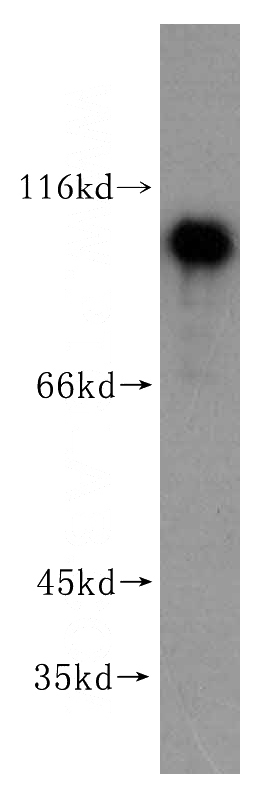 Jurkat cells were subjected to SDS PAGE followed by western blot with Catalog No:113200(NKRF antibody) at dilution of 1:1000